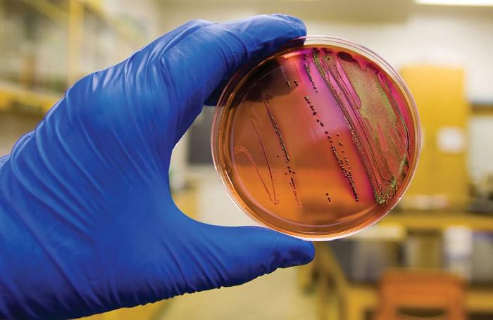 antibiotic resistant escherichia coli