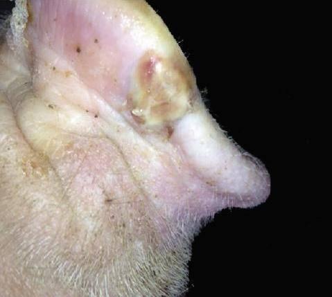 Senecavirus A lesions on pig snout