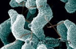 Campylobacter-1607PIbroilercampylobacter1.jpg