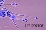 Una fotomicrografía de Fusarium verticillioides.