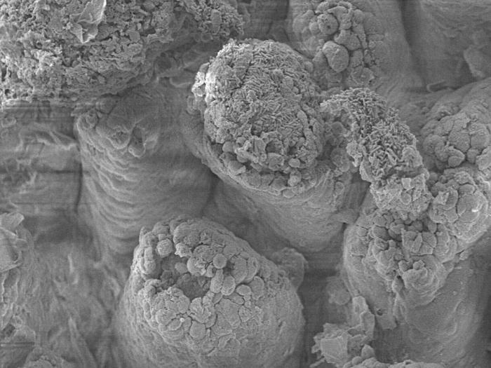 electron micrograph of villi close up