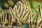 fungi-fusarium-which-produce-mycotoxins-cereal.jpg