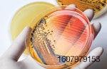 salmonella-bacteria-in-petri-dish-2