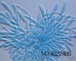 Fusarium-culmorum-1402PIpoultrymycotoxins 1.jpg