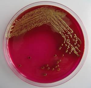 1106IANewsE.coli