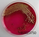 1106IANewsE.coli